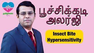 பூச்சிக்கடி அலர்ஜி  Insect Bite Hypersensitivity  Papular Urticaria  தமிழ்