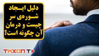 دلیل ایجاد شوره‌ی سر چیست و درمان آن چگونه است؟