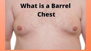 What is a Barrel Chest