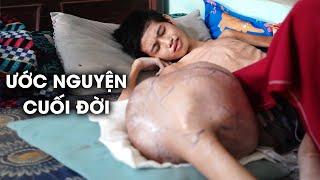 CẬU BÉ 14 TUỔI MANG TRONG MÌNH CĂN BỆNH QUÁI ÁC... VÔ PHƯƠNG CỨU CHỮA