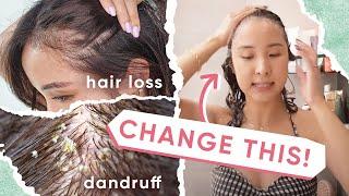 4 Reasons WHY Your Hair Loss & Dandruff ISN’T Getting BETTER + 5 TIPS