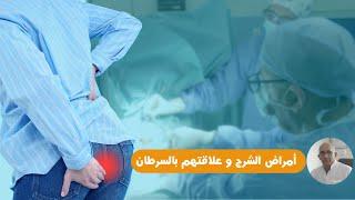 البروفيسور مولاي الحسن طاهري يشرح  أمراض الشرج و علاقتهم بمرض السرطان