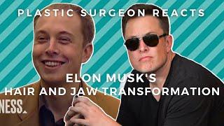 Elon Musks Transformation Plastic Surgeon Reacts to The Founder of Tesla