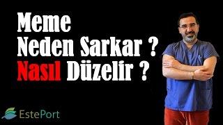 Meme Neden Sarkar ? Nasıl Düzelir ?