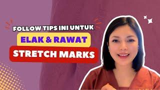 Beauty Tips  Follow tips ini untuk elak dan rawat Stretch Marks