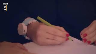 amazing invention helps woman with parkinsons draw like a retard again