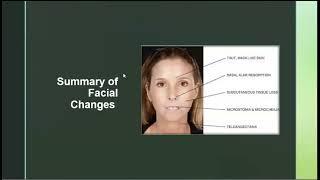 Cosmetic Procedures in Systemic Sclerosis Heidi Jacobe MD MSCS