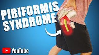 Persistent Buttock Pain. BEST STRETCHES EXERCISES & ADVICE for PIRIFORMIS SYNDROME..