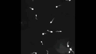 Sperm Motility - Faz Kontrast Mikroskobunda Sağlıklı ve Matür Spermlerin Görüntüsü