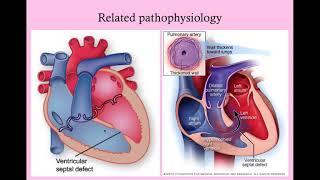 Cardiac Disease in Pregnancy - CRASH Medical Review Series