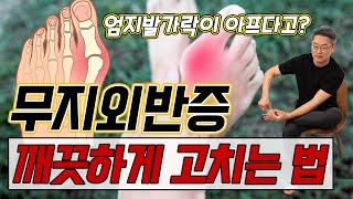 엄지발가락 통증 간단하게 해결하는 법  - 김범수의 100세 시대 두 발 혁명 #2 ㅣ무지외반 발가락통증 발통증 스트레칭 발근육강화 발코어근육