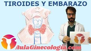 TIROIDES y EMBARAZO HIPOTIROIDISMO e HIPERTIROIDISMO   - Ginecología y Obstetricia -