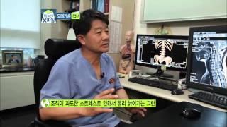 Maspeople xfile Ep.98 큰 가슴으로 인한 고충... 의사도 놀란 화성인 상태는?