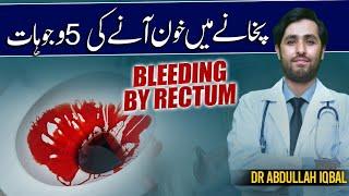 Learn the 5 Unexpected Reasons of Blood In Stool  Bleeding By Rectum  Pakhane Me Khoon Ane Ki Waja