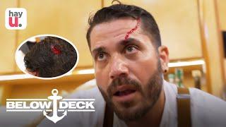 Chef Cuts His Head Open  Season 3  Below Deck Sailing Yacht