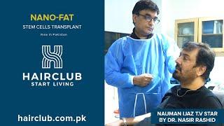 Nauman Ijaz T.V Star underwent Nano-Fat Stem Cells Transplant by Dr. Nasir at Hair Club