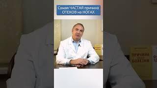 ОТЕКАЮТ НОГИ  что делать?