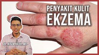 Ekzema Eczema - Apa Yang Anda Patut Tahu  Punca dan Penyebab  Ubat Ekzema  Bayi dan Dewasa