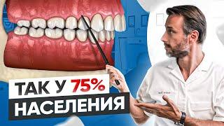 Самый популярный вид неправильного прикуса у человека #3  Дистальный прикус