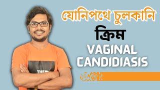 Vaginal cream  যোনিপথ বা প্রস্রাবের রাস্তায় ভ্যাজাইনাল ক্যানডিডিয়াসিস চুলকানি হলে ক্রিম