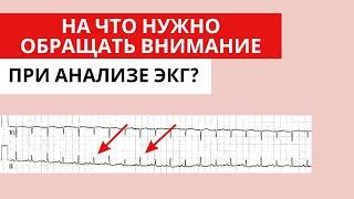 Что НЕ стоит игнорировать при анализе ЭКГ?  На что стоит обращать внимание при анализе ЭКГ?