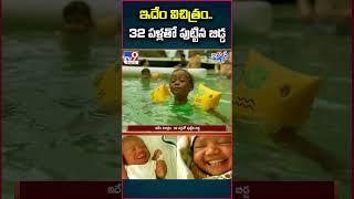 iSmart News  ఇదేం విచిత్రం.. 32 పళ్లతో పుట్టిన బిడ్డ..  Baby Born With 32 Teeth  - TV9