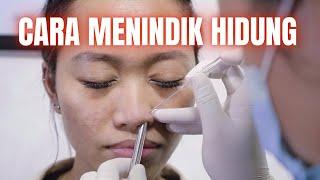 Cara Menindik Hidung - PIERCING JAKARTA