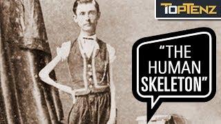 P. T. Barnum’s 10 Most Famous Human “Freak” Show Attractions