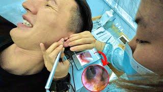 Intense Chinese Earwax Removal 