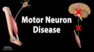 Motor Neuron Disease Animation