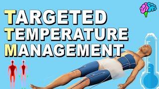Targeted Temperature Management TTM - Therapeutic Hypothermia - Hypothermia Protocol