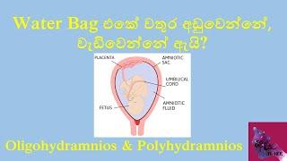 Water Bag එකේ වතුර අඩුවෙන්නේ වැඩිවෙන්නේ ඇයි