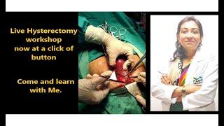 Hysterectomy in previous 3 c sections.......watch and learn