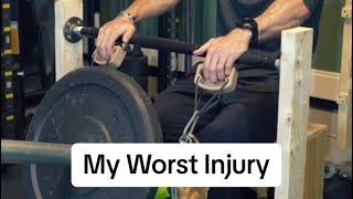 My Worst Injury - Accidents Happen