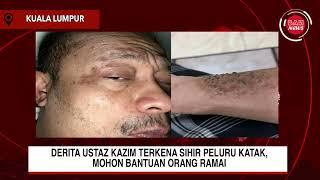 DERITA USTAZ KAZIM TERKENA SIHIR PELURU KATAK MOHON BANTUAN ORANG RAMAI