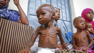 Сомали 45% населения  - на грани голода