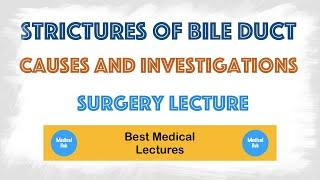 Stricture of Bile Duct  Causes and Investigations
