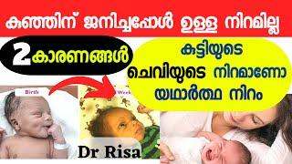 Baby Skin ColorBaby Skin Whitening MalayalamBaby Care Tips