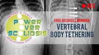 2021 Vertebral Body Tethering Webinar    Power Over Scoliosis