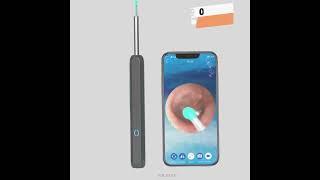 Ear Cleaner Otoscope Ear Wax Removal Tool With Camera LED Light Wireless Ear Endoscope Ear Clean