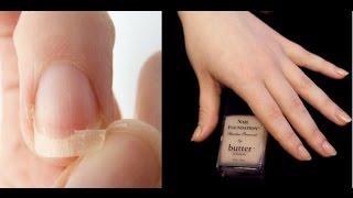 How to Strengthen Weak Brittle Nails  Chat