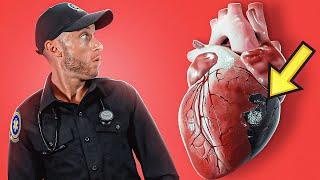 CARDIOGENIC SHOCK Explained In Under 6 Minutes