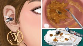 ASMR The best treatment and remove flies and slimes in girls ears  실감나는 케어 애니메이션 2023