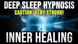 Gentle Sleep Hypnosis ️ Heal Your Inner Child Very Strong