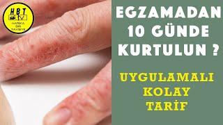 Egzama Nasıl Geçer Ellerdeki Egzamadan Kurtulmanın Kolay Tarifi Beyaz Dut Kurusu Kürü Tarifi #