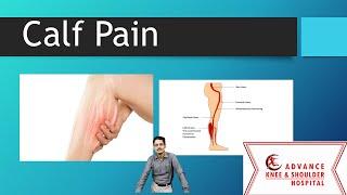 Calf Pain  Cause Prevention and Treatment