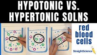Hypotonic Hypertonic and Isotonic Solutions - What happens to a red blood cell?