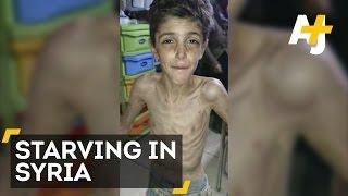 Children Are Starving To Death In Madaya Syria