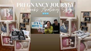 OUR 20 weeks ANATOMY SCAN 🩵 #pregnancyjourney  #pregnancy #wearepregnant #20weekspregnant