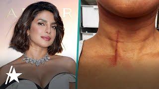 Priyanka Chopra Shows Off Neck Injury She Sustained Doing Her Own Stunts